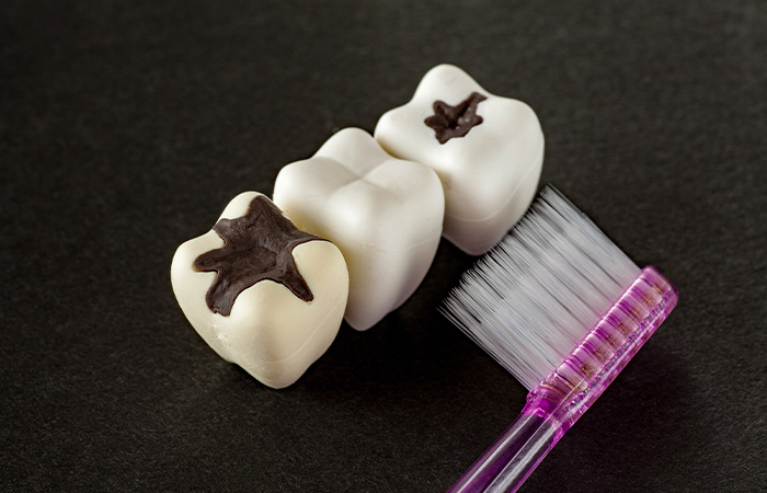 むし歯の原因は？